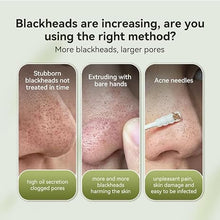 LANBENA Blackhead Remover Mask – Aloe Vera Nose Pore Strips