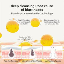 LANBENA Blackhead Remover Mask – Aloe Vera Nose Pore Strips